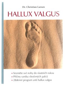 HALLUS VALGUS